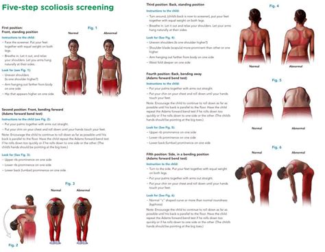 adams test for scoliosis